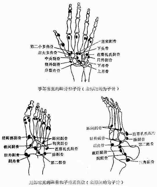 手、足骨骼之解剖變異