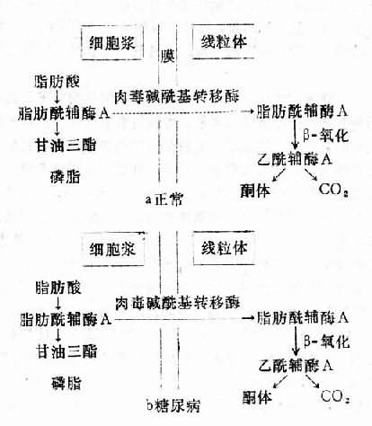 糖尿病酮症酸中毒的可能機制