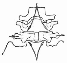 寰椎受力示意－冠狀位