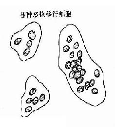 正常人尿液內的各種移行細胞示意圖