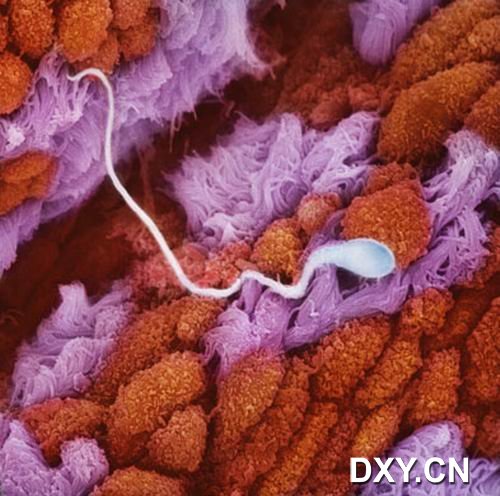 一個精子正在徘徊于輸卵管黏膜褶皺區域，尋找結合的卵子