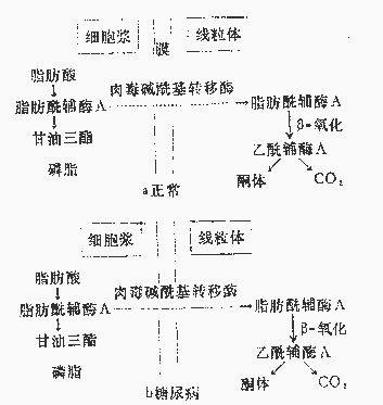 糖尿病酮症酸中毒的可能机制