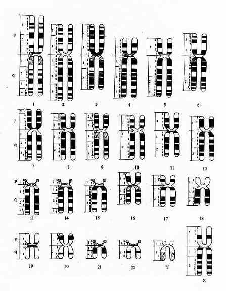 顯帶染色體模式圖（巴黎會議，1971）