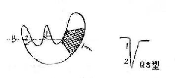 A正常心室除極、在左室外膜電極示qR型波群