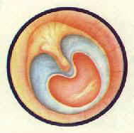 慢性化膿性中耳炎中央性大穿孔中耳粘膜充血