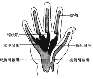 手屈指肌腱鞘、滑液囊和手掌深部間隙的解剖位置示意圖