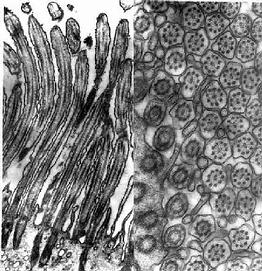大鼠输卵管上皮细胞纤毛电镜像