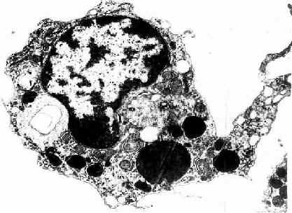 猴巨噬細胞電鏡像