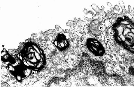 人肺泡Ⅱ型細胞電鏡像