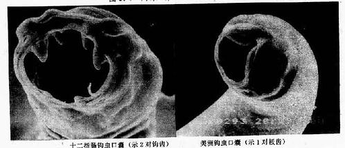兩種鉤蟲口囊掃描電鏡圖