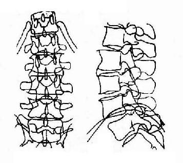 腰椎退行性骨关节病（正、侧位），示骨赘及骨桥形成