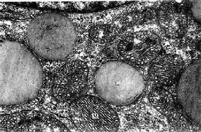 猴腎上腺皮質束狀帶細胞電鏡像