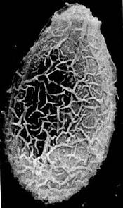 華支睾吸蟲卵掃描電鏡圖