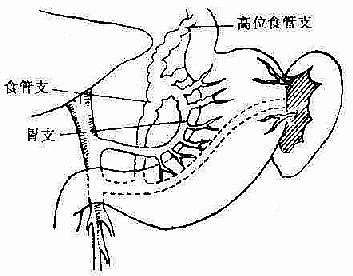 冠狀靜脈局部解剖示意圖