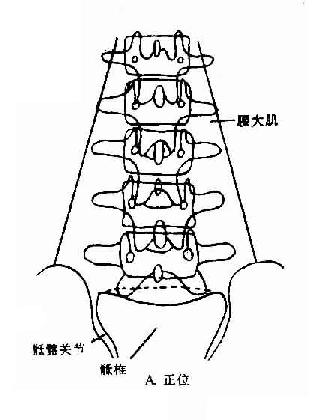 正常腰椎X线解剖