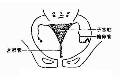 正常子宮輸卵管造影