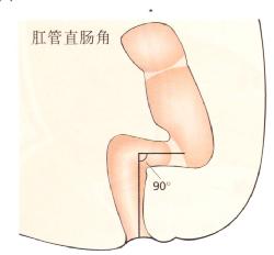 肛管直腸角