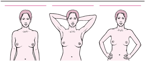 乳房自我检查