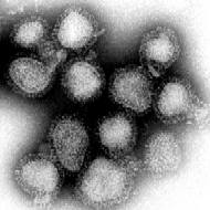 甲型流感病毒H3N2亚型（香港流感）