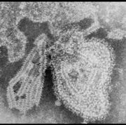 TEM 显微镜下的病毒（mumps virus）.