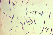 顯微鏡下呈革蘭氏陽性的產氣莢膜梭菌