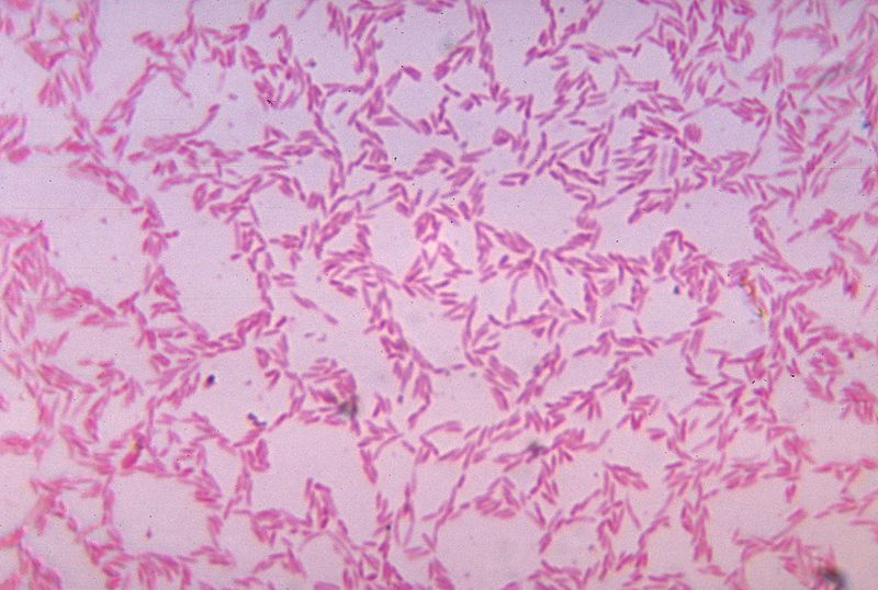 File:Bacteroides biacutis 01.jpg