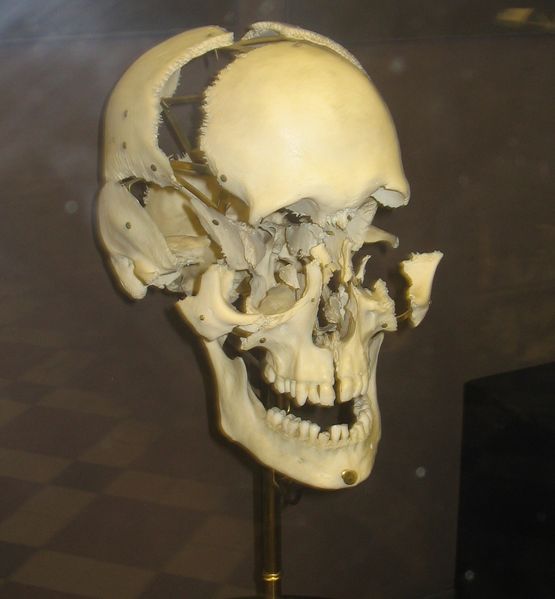 File:Exploded Human Skull.jpg