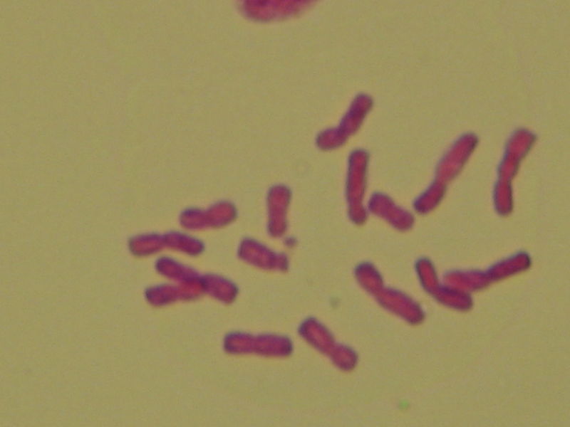 File:Chromosomes of Allium ascalonicum.jpg
