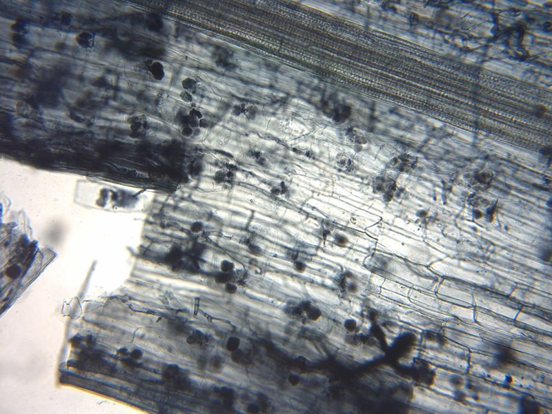 文件:Arbuscular mycorrhiza microscope.jpg