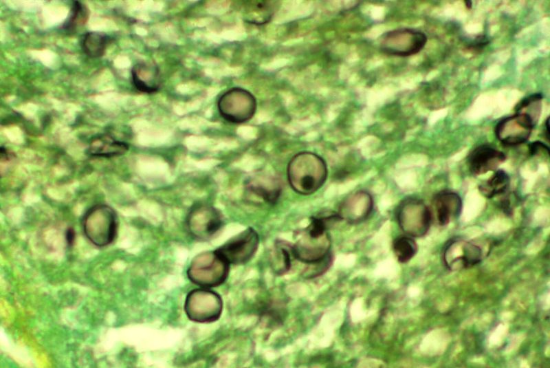 File:Pneumocystis carinii 01.jpg