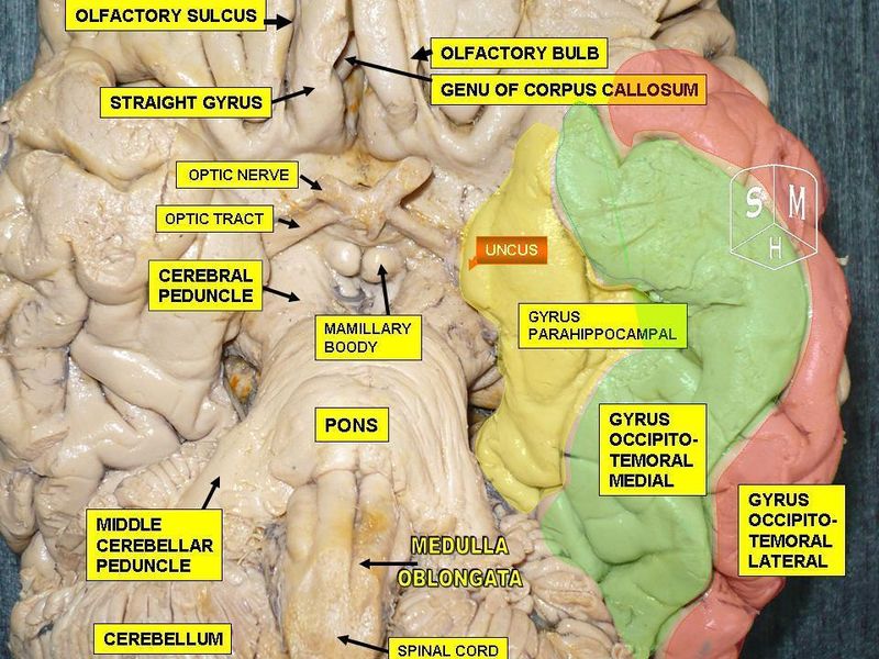 File:Parahippocampal gyrus.jpg