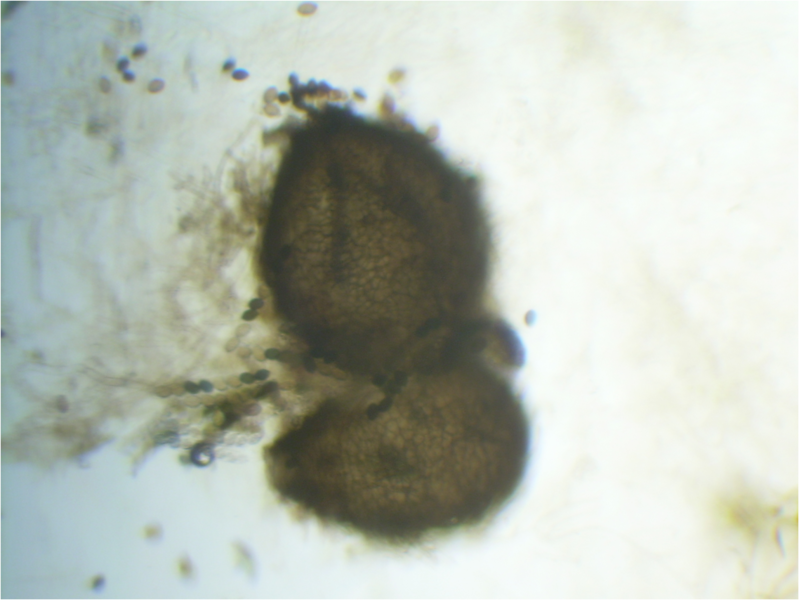 File:Sordaria fimicola perithecium (heterozygote) 40X.png
