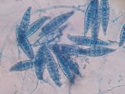 此为犬小芽胞菌的梭状大分生孢子，可观察到分格细胞的隔膜（septate），如图所示，典型犬小芽胞菌的大分生孢子有超过六个隔膜以分隔细胞