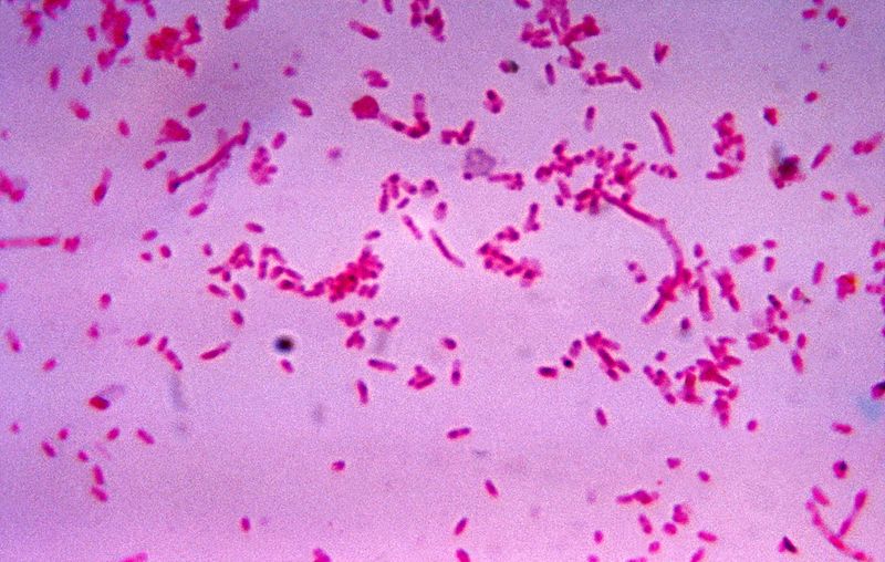 文件:Fusobacterium novum 01.jpg