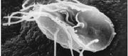 籃氏賈第鞭毛蟲，一種人體寄生蟲